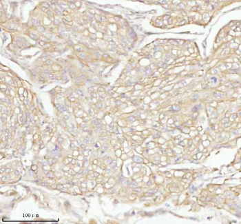 Anti-TAS2R10 Antibody
