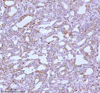 Anti-ME3 Antibody