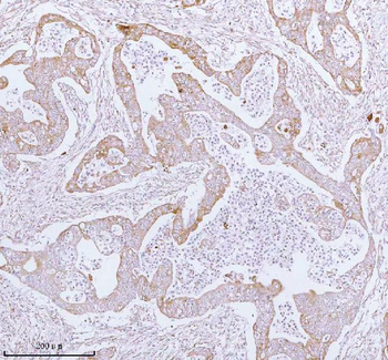 Anti-ME3 Antibody