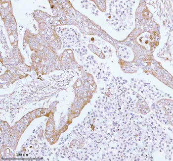 Anti-ME3 Antibody