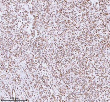 Anti-ME3 Antibody
