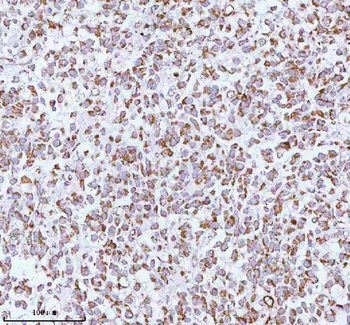 Anti-ME3 Antibody