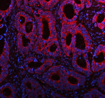 Anti-ME3 Antibody
