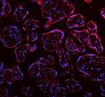 Anti-ME3 Antibody