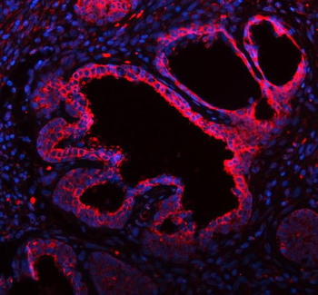 Anti-ME3 Antibody