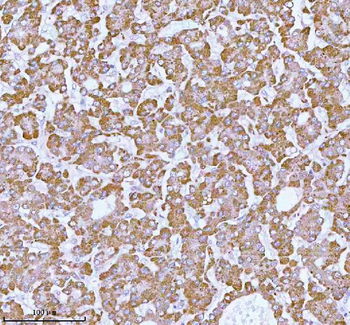 Anti-ME3 Antibody