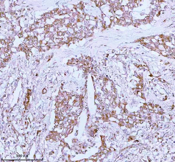 Anti-ME3 Antibody