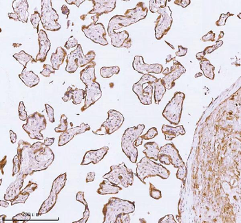 Anti-ME3 Antibody