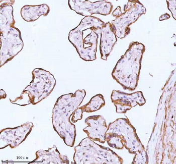 Anti-ME3 Antibody