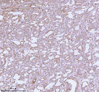 Anti-ME3 Antibody