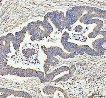 Anti-LARG/ARHGEF12 Antibody