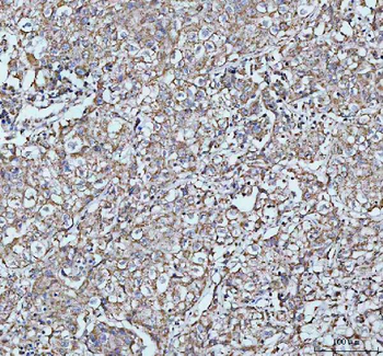 Anti-LARG/ARHGEF12 Antibody
