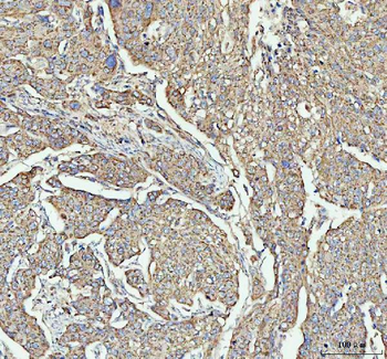 Anti-LARG/ARHGEF12 Antibody