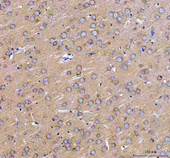 Anti-LARG/ARHGEF12 Antibody