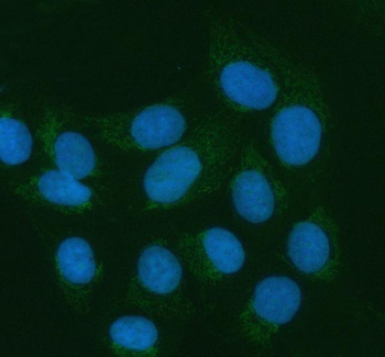 Anti-ATL1 Antibody