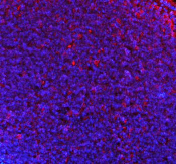 Anti-p47 phox/NCF1 Antibody