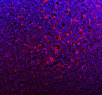 Anti-p47 phox/NCF1 Antibody
