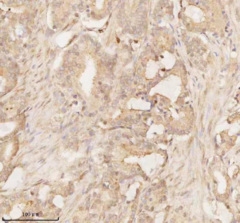 Anti-ARHGEF7 Antibody
