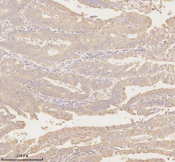 Anti-ARHGEF7 Antibody