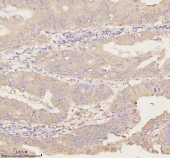 Anti-ARHGEF7 Antibody
