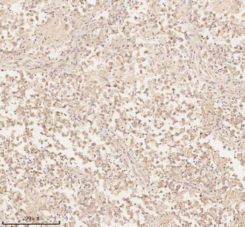 Anti-ARHGEF7 Antibody