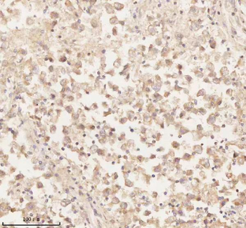 Anti-ARHGEF7 Antibody