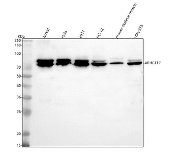Anti-ARHGEF7 Antibody