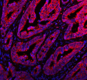 Anti-ARHGEF7 Antibody