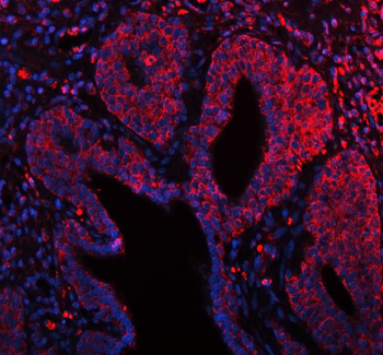 Anti-ARHGEF7 Antibody
