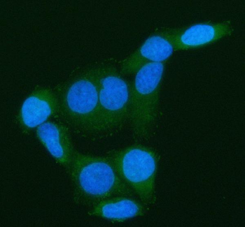 Anti-ARHGEF7 Antibody