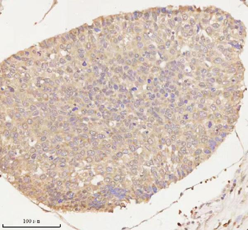 Anti-ARHGEF7 Antibody