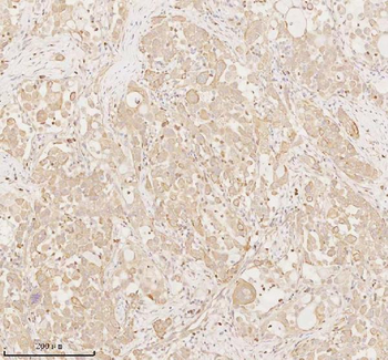 Anti-ARHGEF7 Antibody