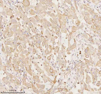 Anti-ARHGEF7 Antibody