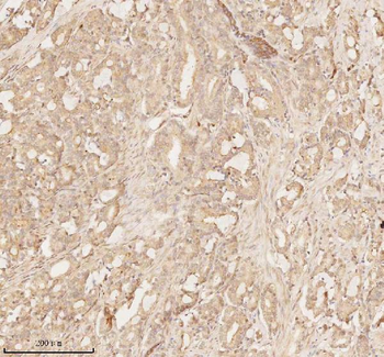 Anti-ARHGEF7 Antibody