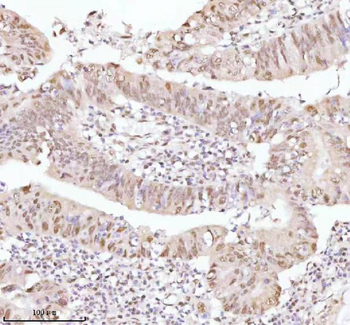 Anti-ASH2L Antibody