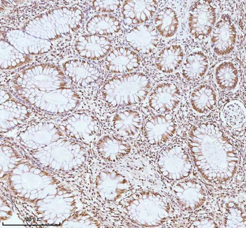 Anti-ASH2L Antibody