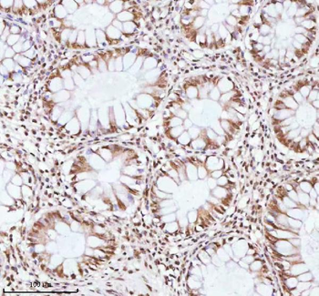 Anti-ASH2L Antibody