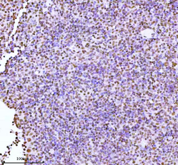Anti-ASH2L Antibody