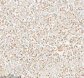 Anti-ASH2L Antibody