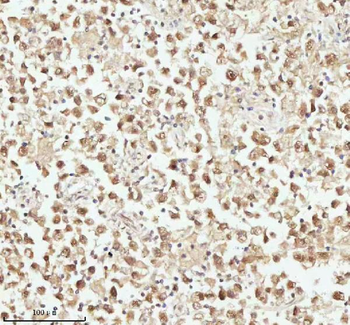 Anti-ASH2L Antibody
