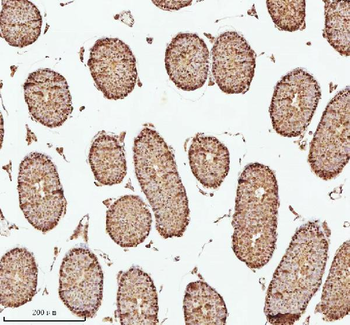 Anti-ASH2L Antibody