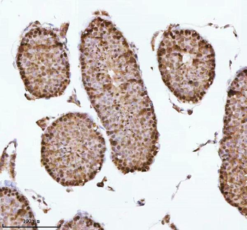 Anti-ASH2L Antibody