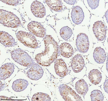 Anti-ASH2L Antibody