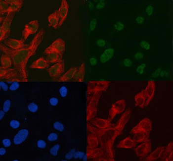 Anti-ASH2L Antibody