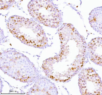 Anti-ASH2L Antibody
