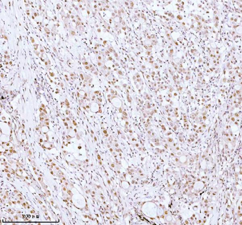Anti-ASH2L Antibody