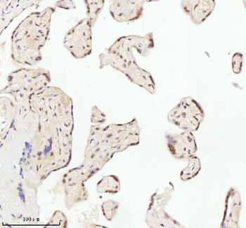 Anti-ASH2L Antibody