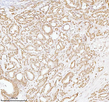Anti-ASH2L Antibody
