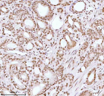 Anti-ASH2L Antibody