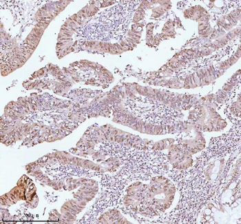 Anti-ASH2L Antibody